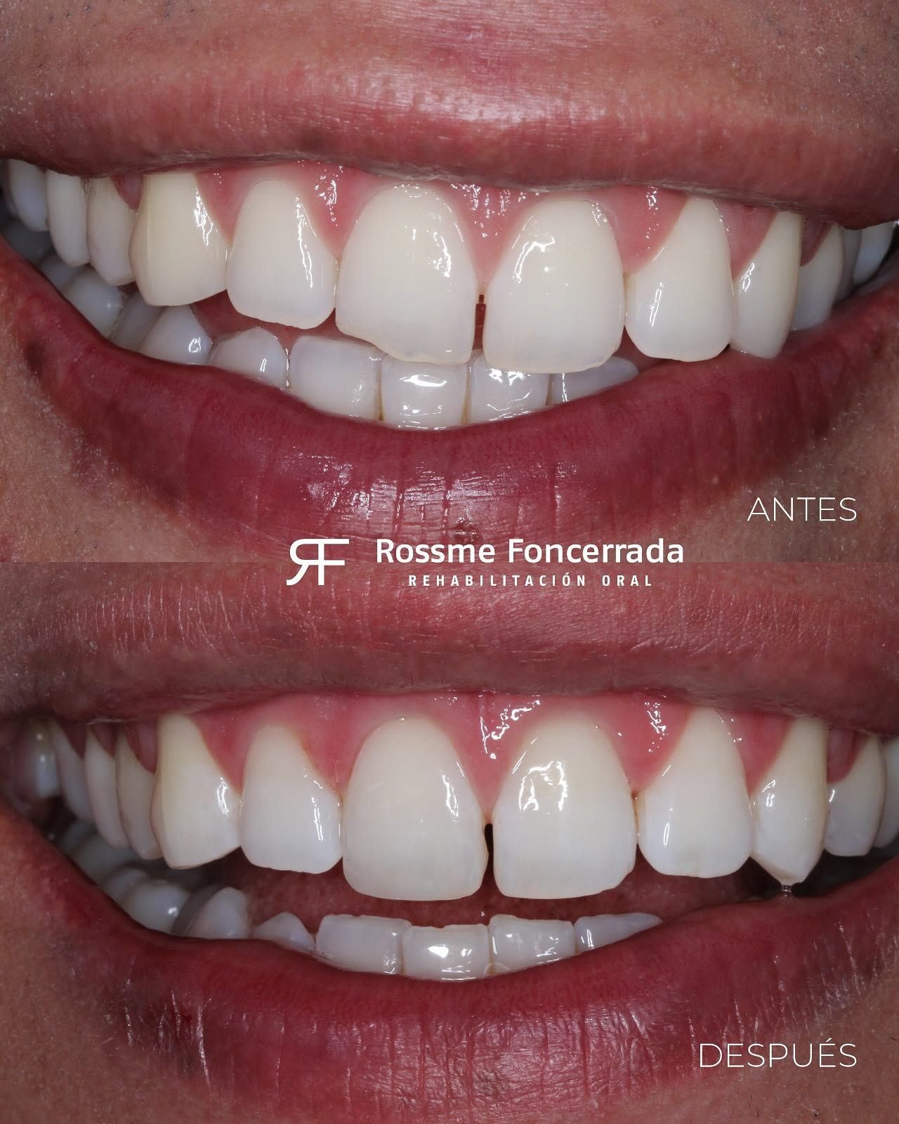 Rossme Foncerrada-20