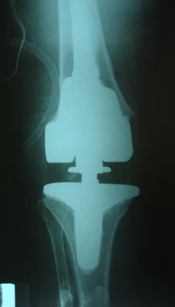 Rubén Rodriguez Acosta-10