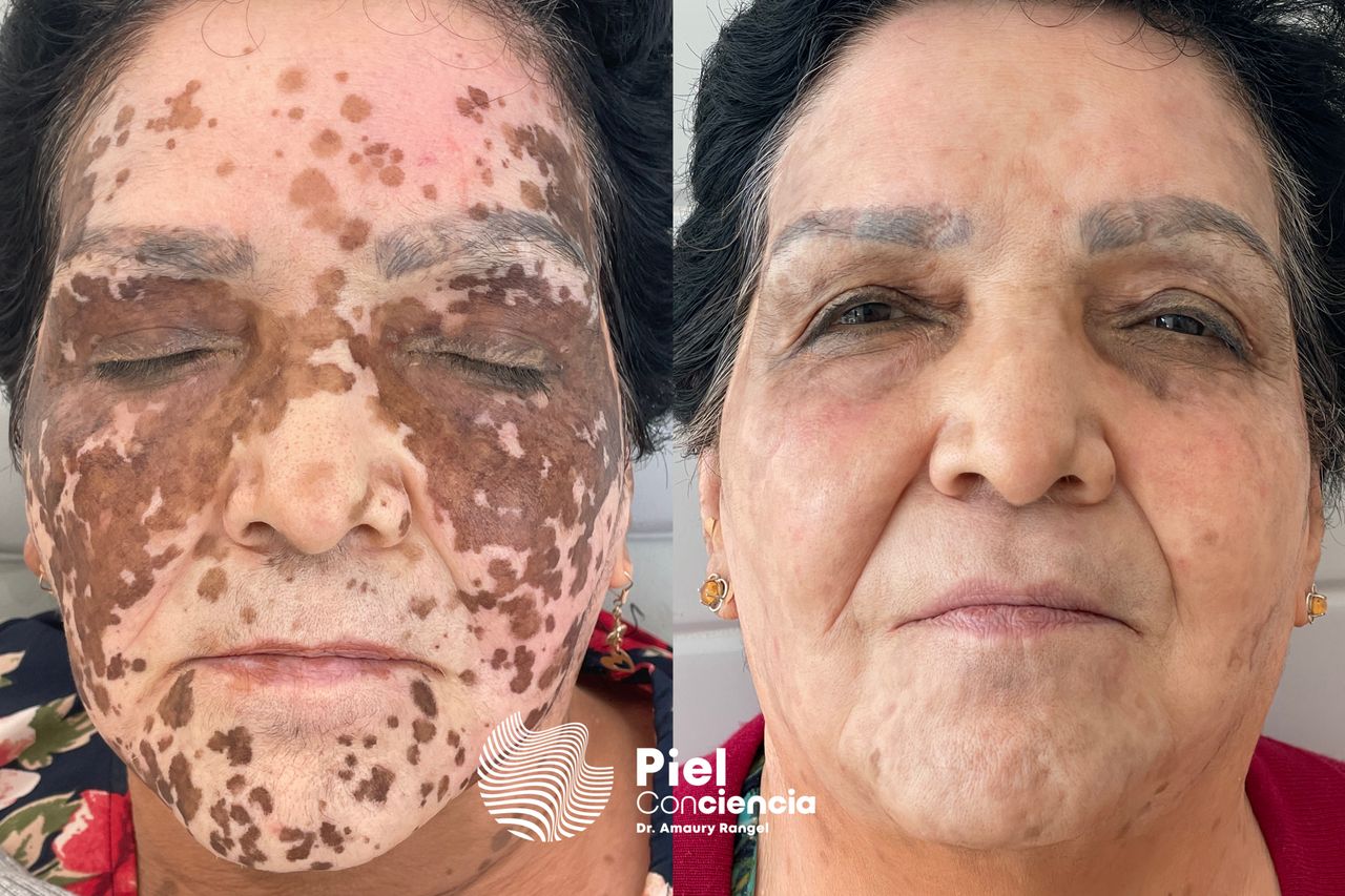 Víctor Amaury Rangel Avilés-31