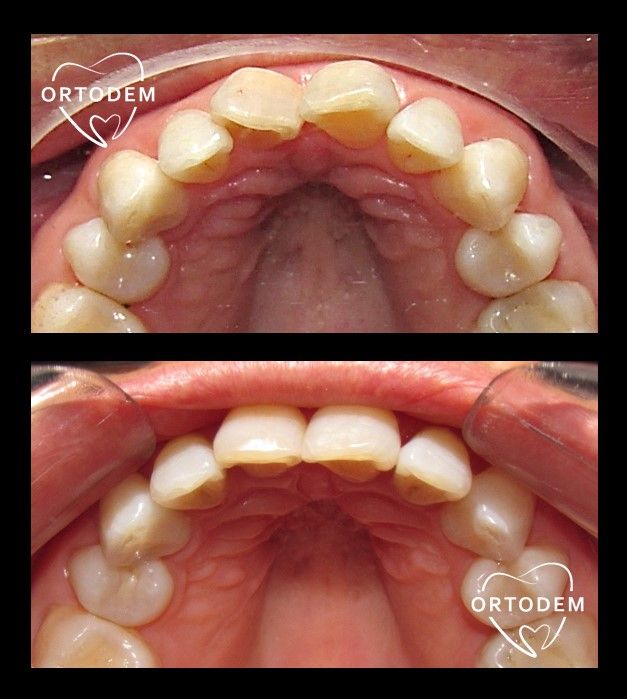 Elizabeth Morelos Morales-21