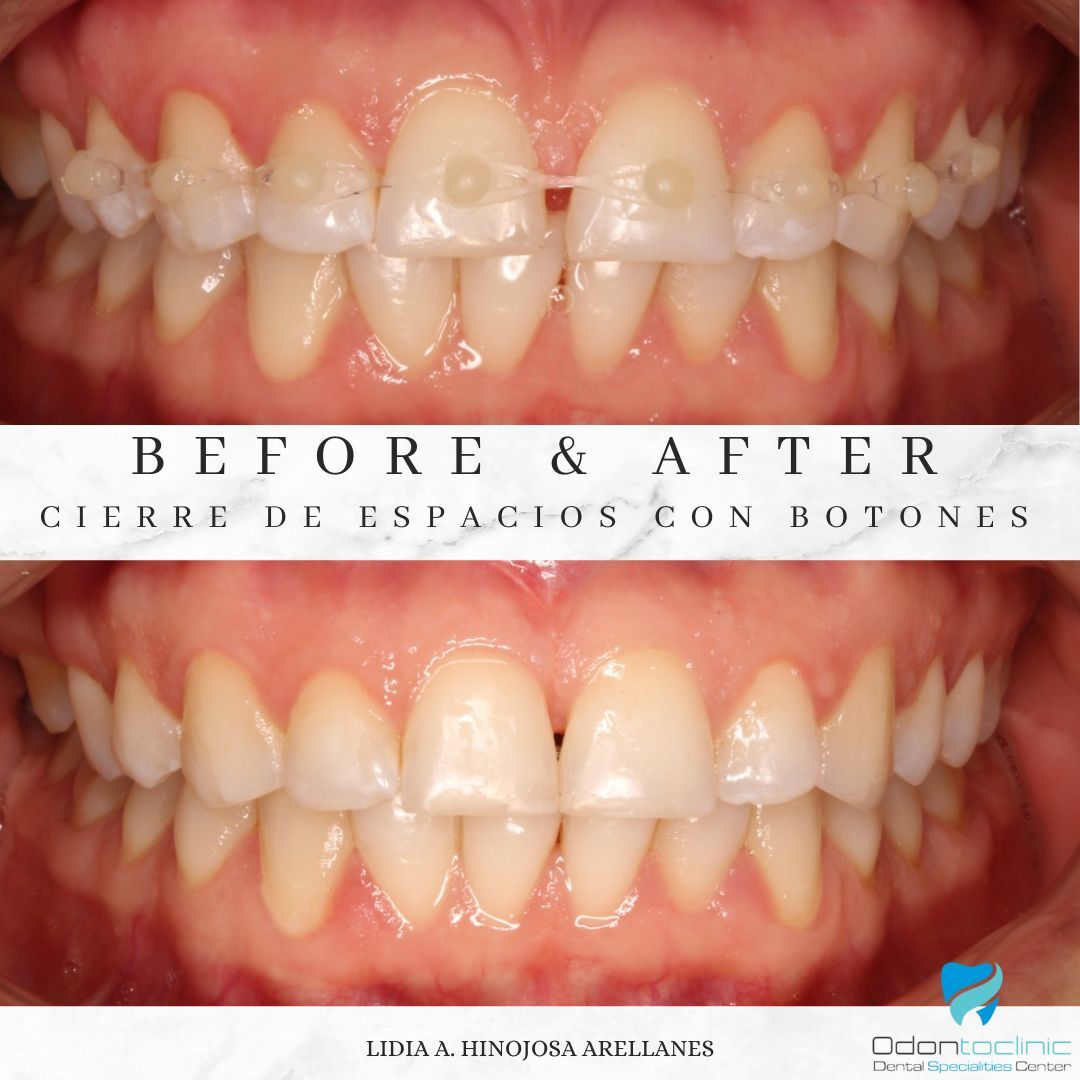 Lidia Abigail Hinojosa Arellanes-25