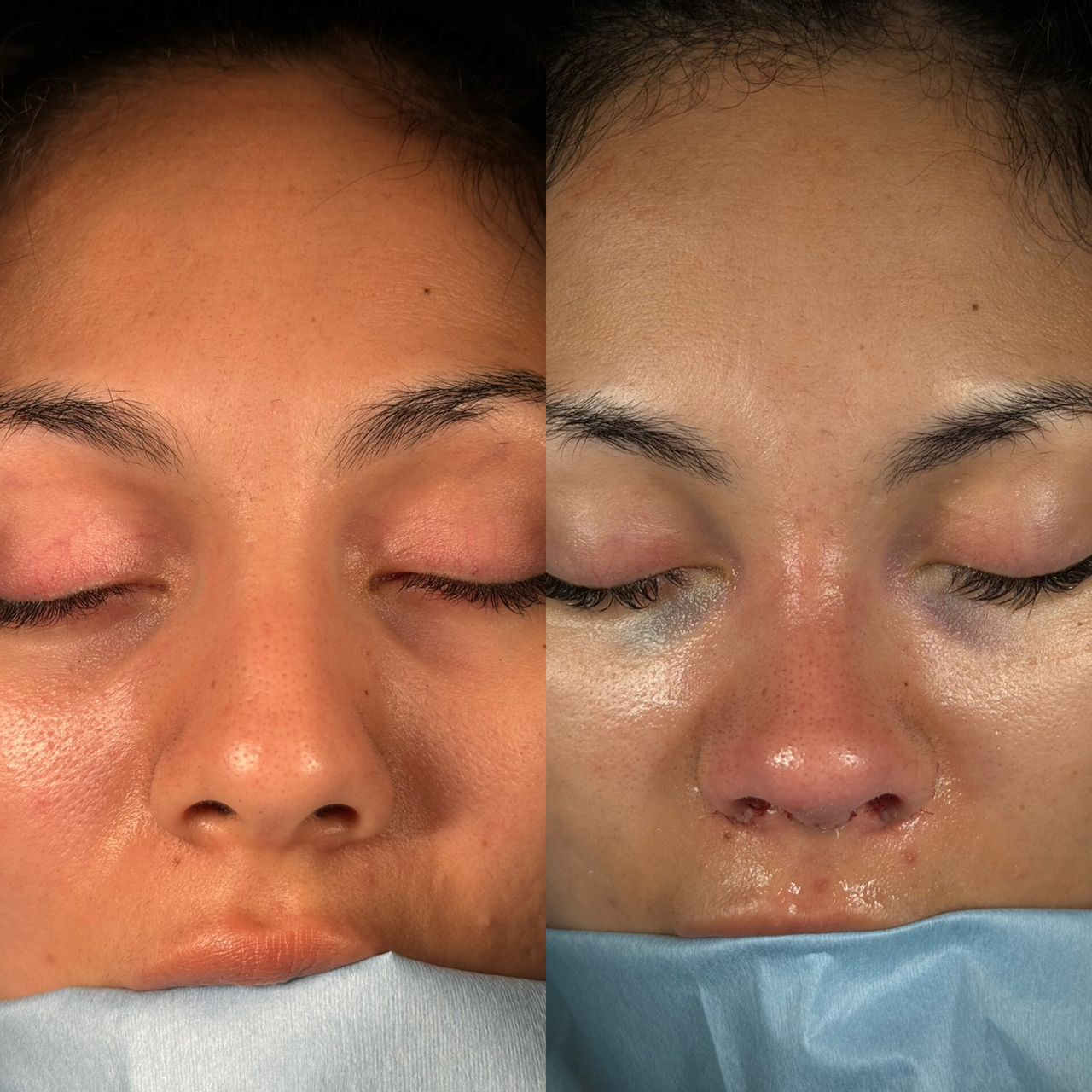 Angel Castro Urquizo-118