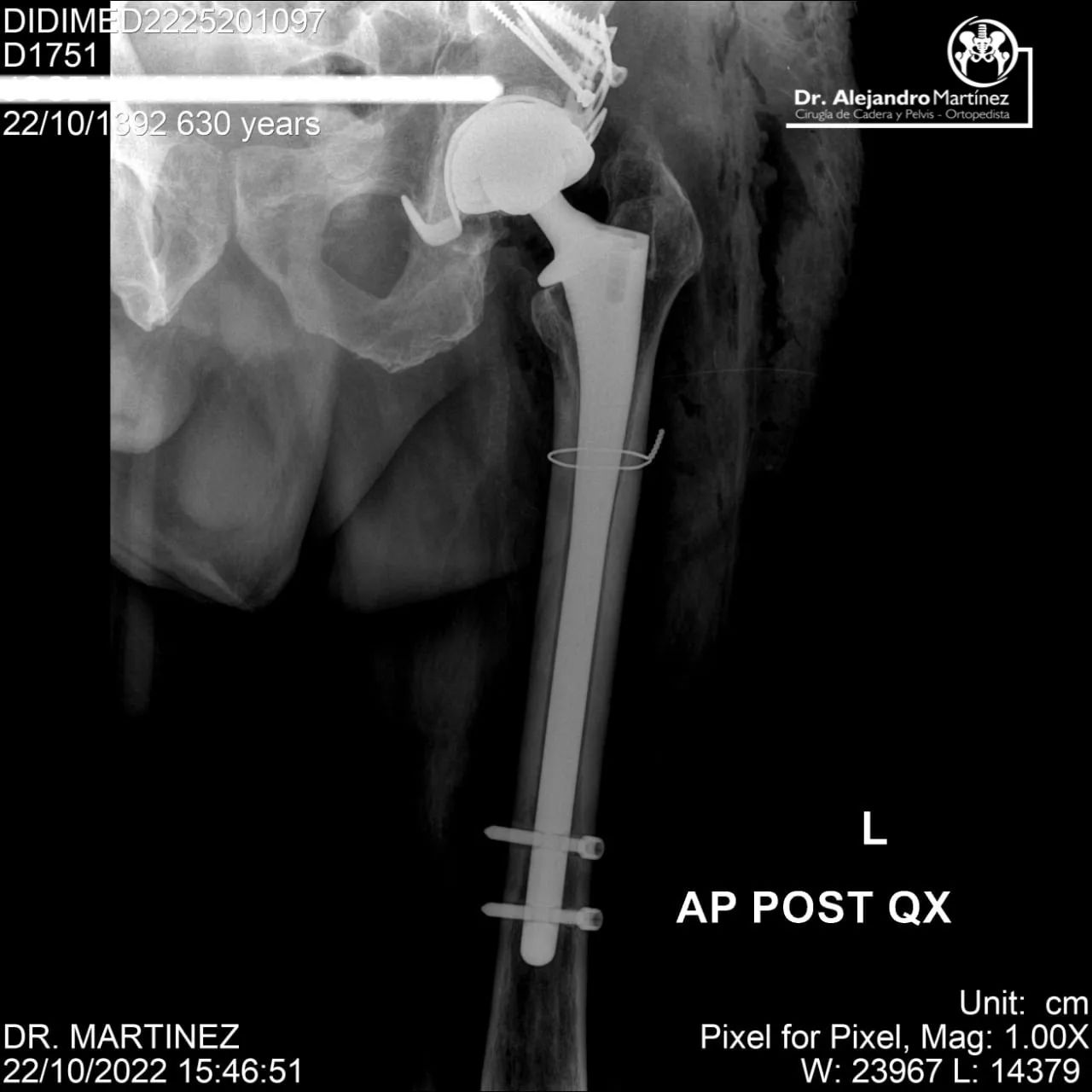 Alejandro Martínez Ramírez-5