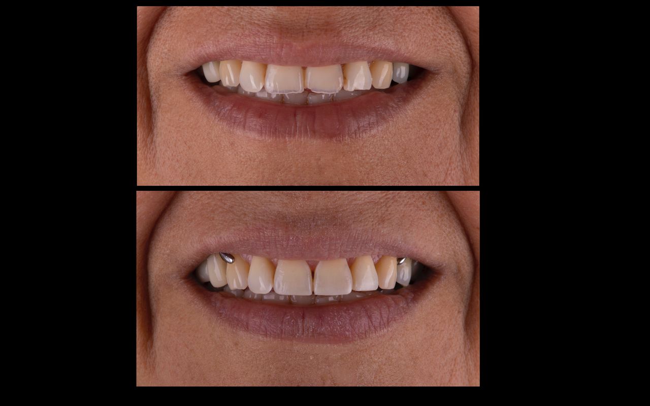 María Fernanda González Gastelum-3