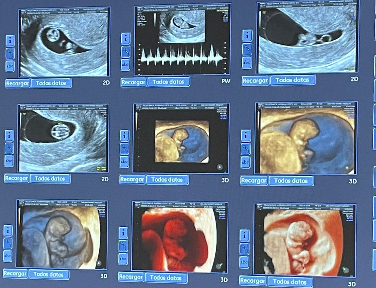 Mayi Mayret Mesquiti-17