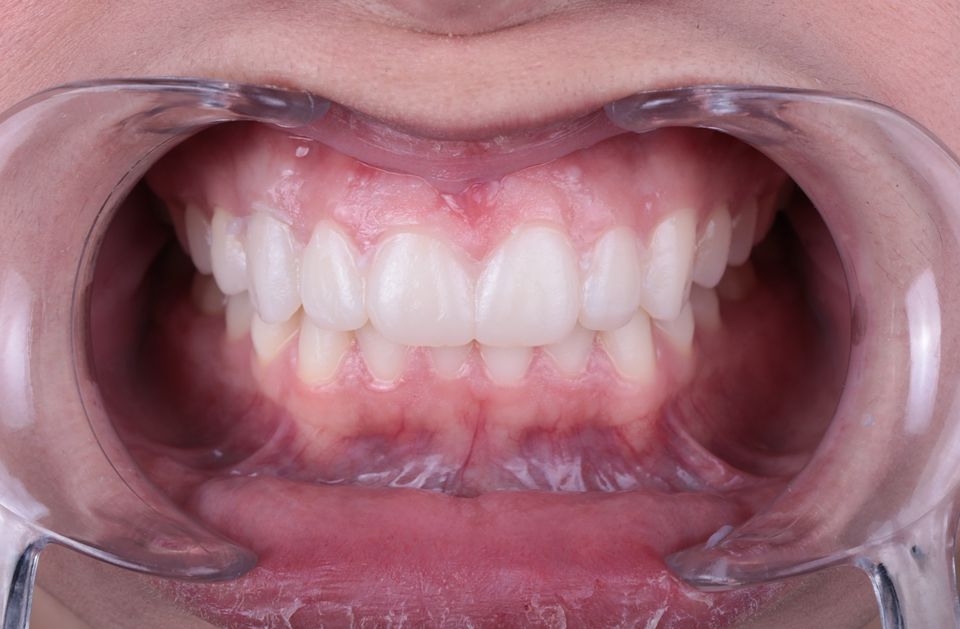 Carlos Enrique Hernández Rodríguez-3