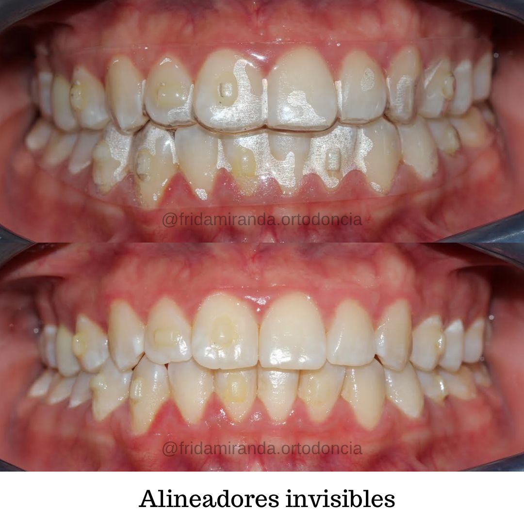 Frida Miranda Alcantar-5