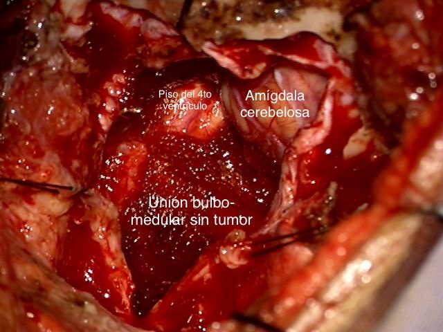 Celia Teresa De Jesús Álvarez Gamiño-34