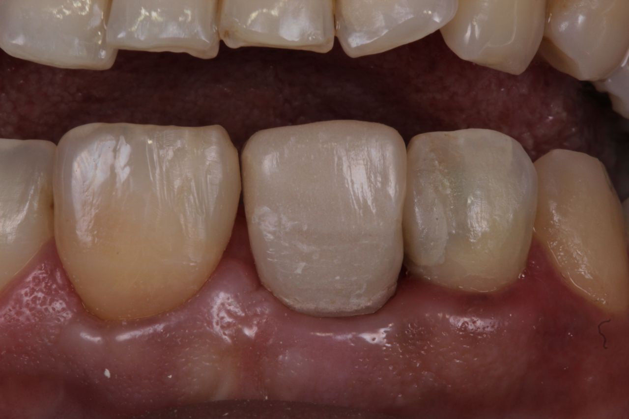 Fernando Fuentes Lozada-3