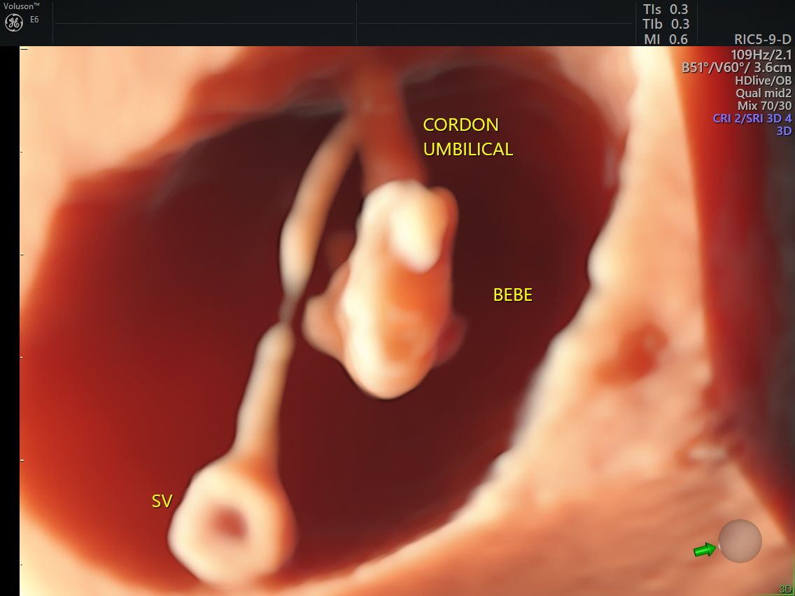 Edgardo Reyes Ponce-4