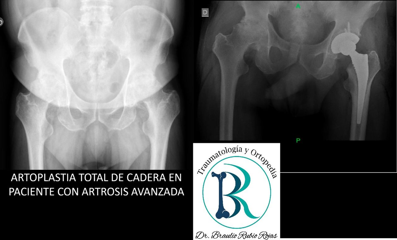 Braulio Rubio Rojas-1