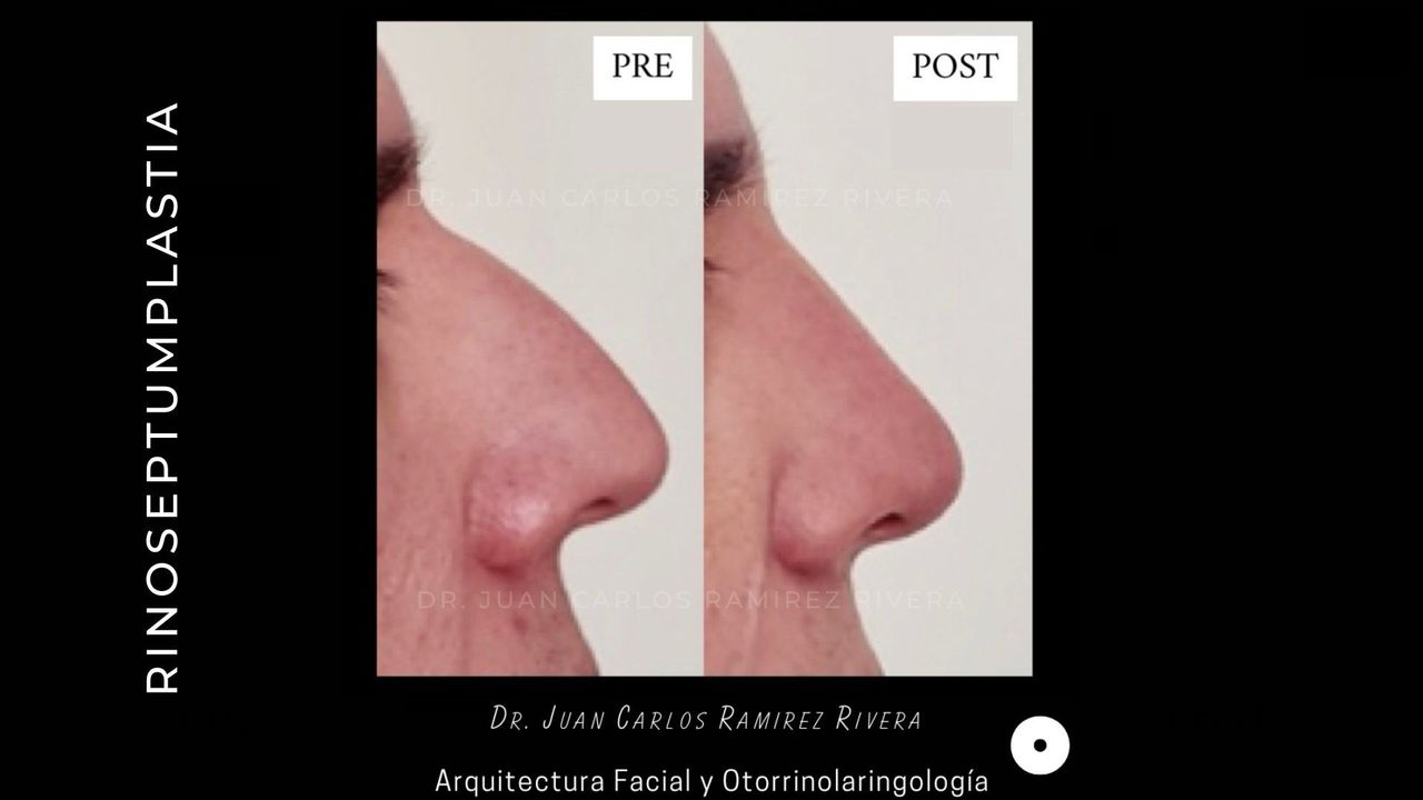 Juan Carlos Ramirez Rivera-2