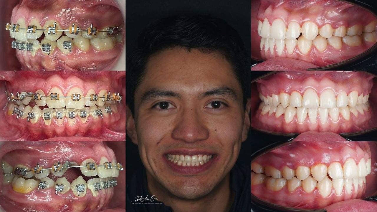 Alan Edgardo Ortiz Arenas-0