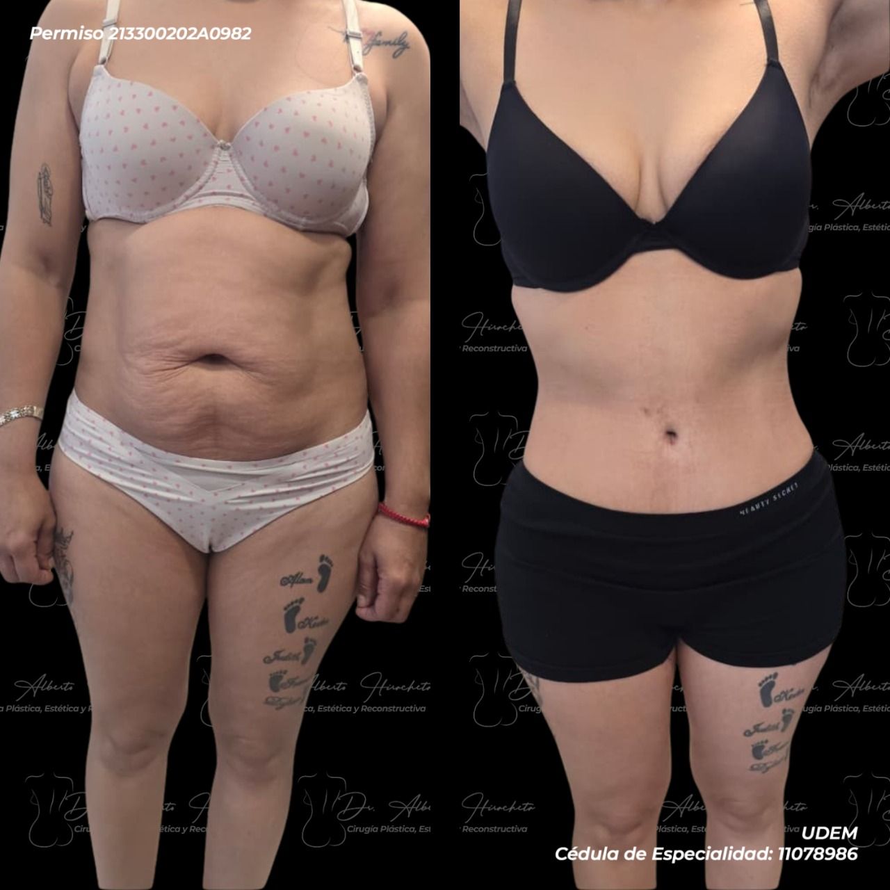 Alberto Hiracheta Torres-32