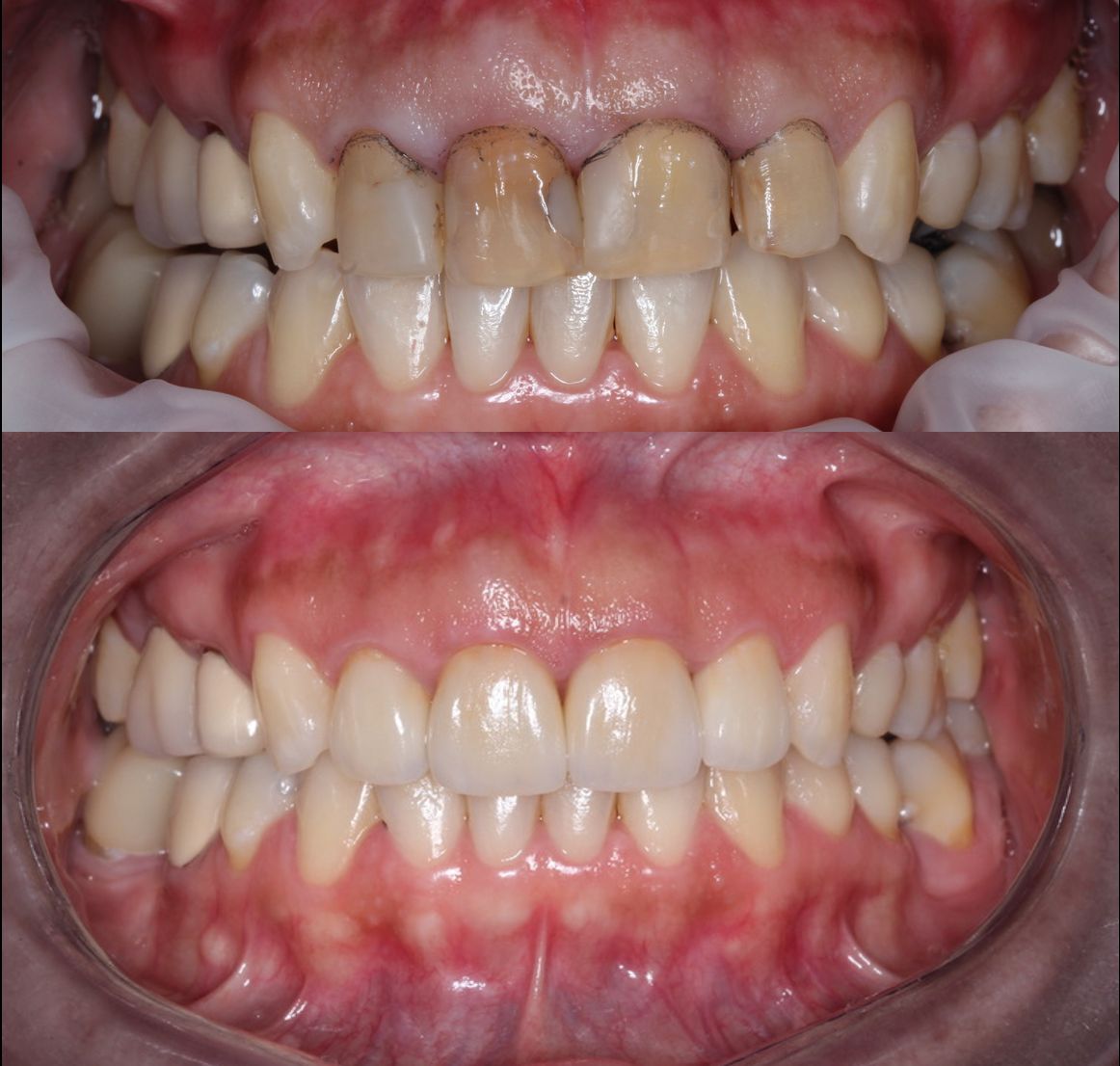 Bielmy Veronica Jonapa Peña-5