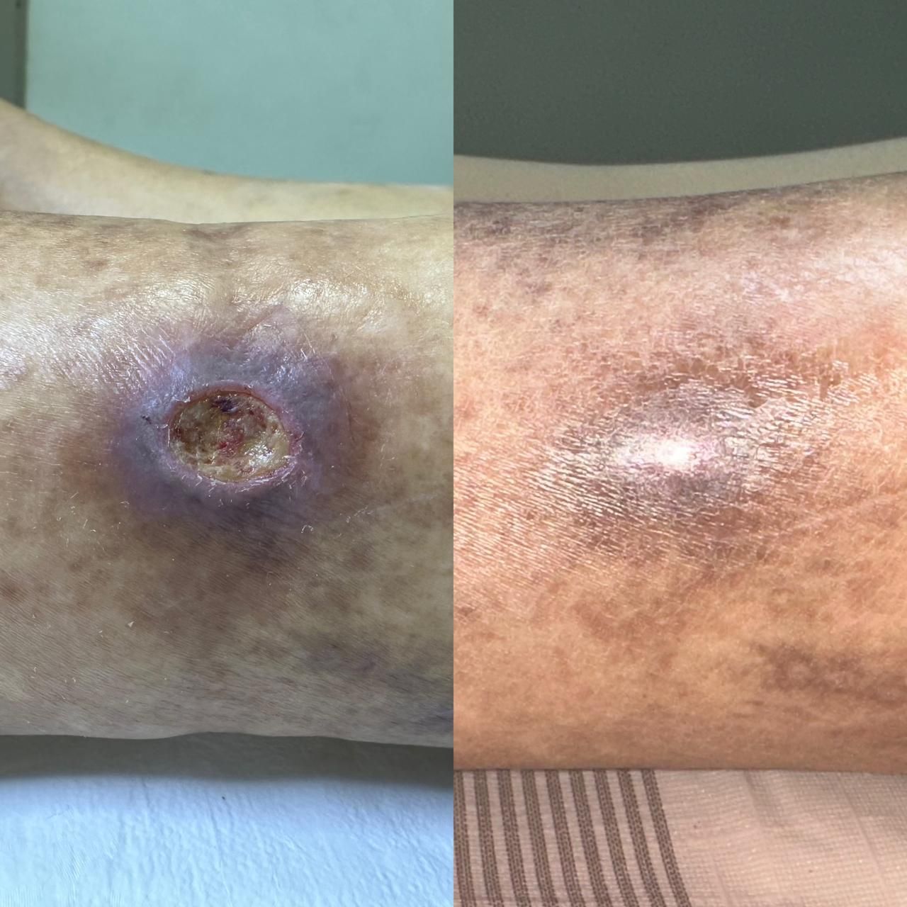 Jhonatan López González-46