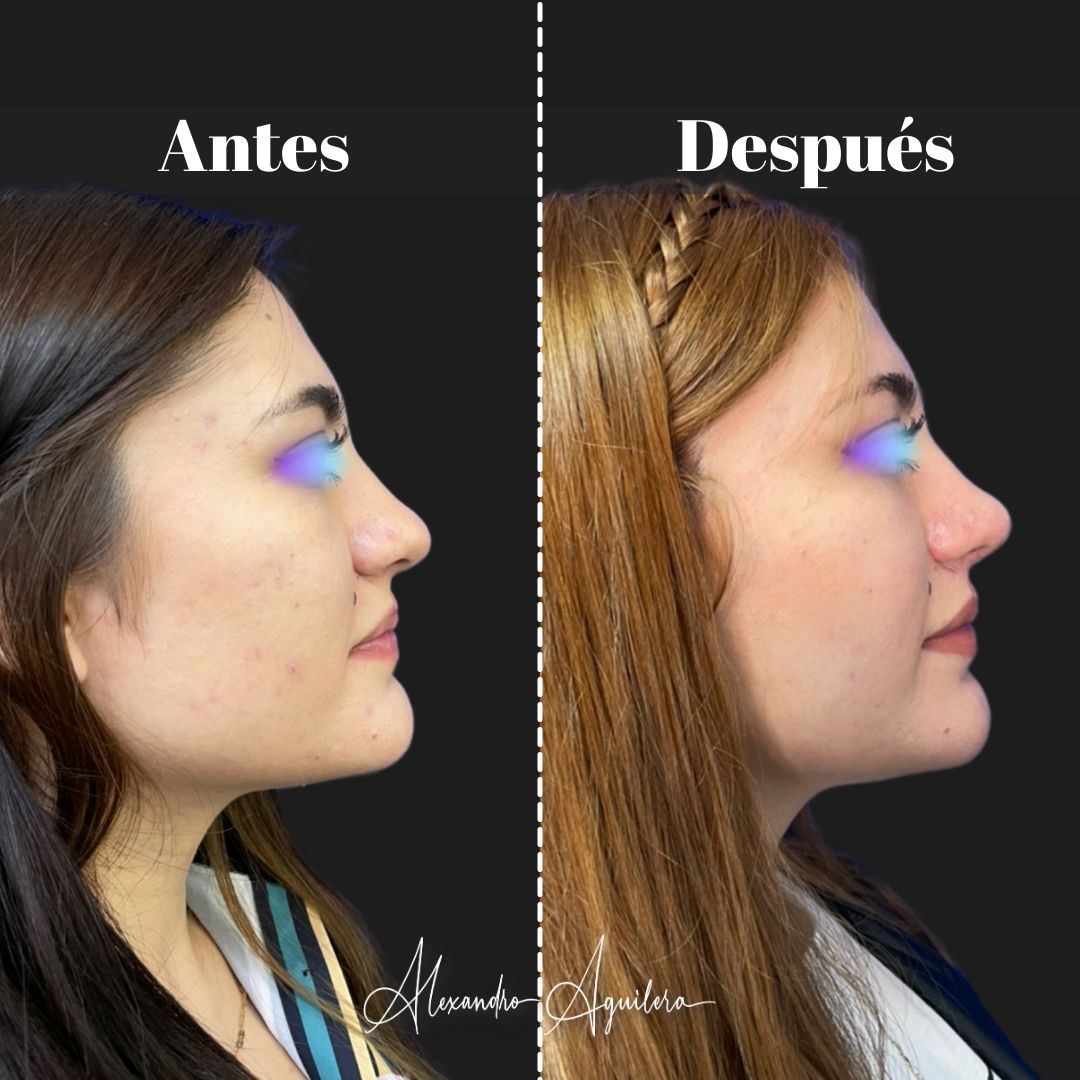 Alexandro Aguilera Salgado-41