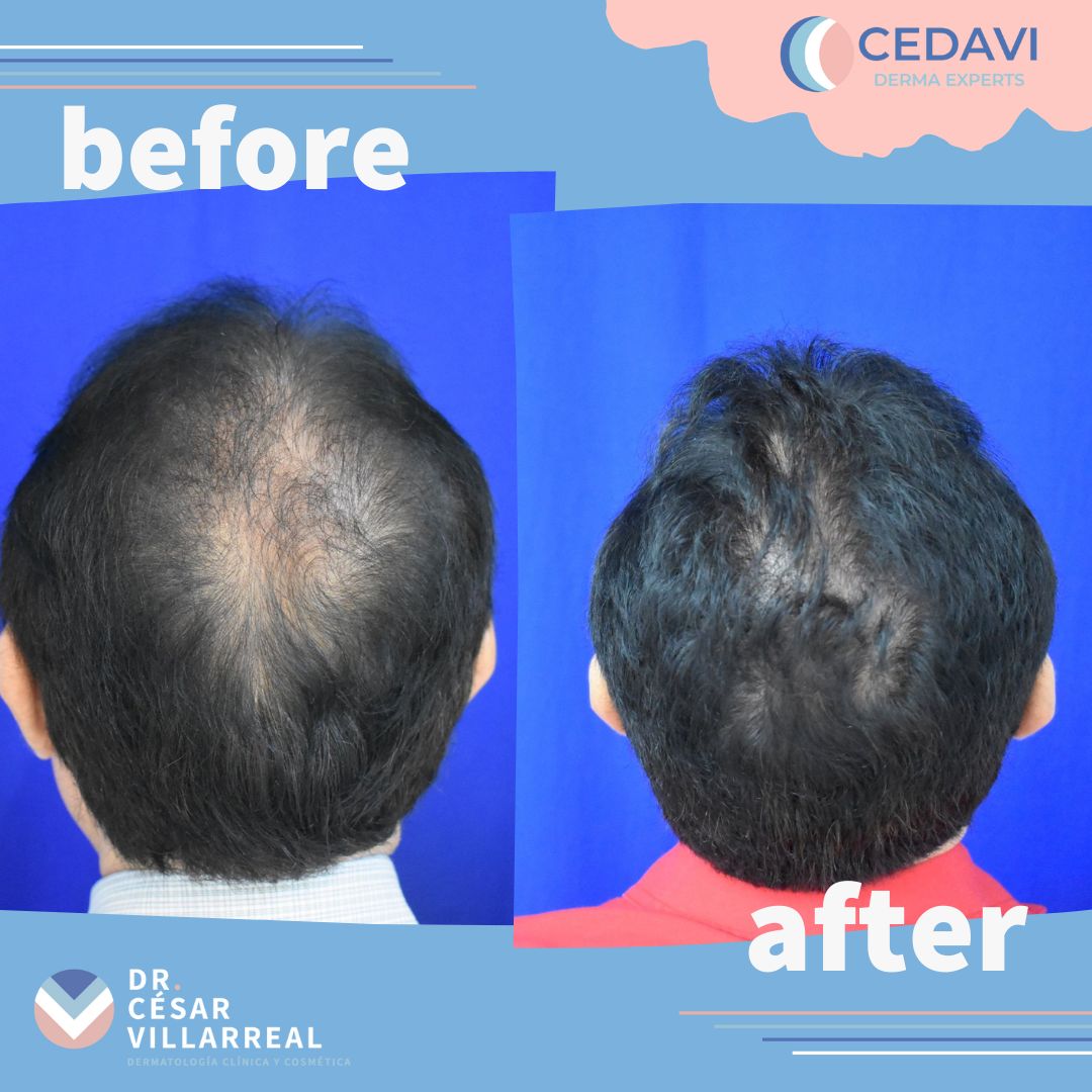 César Daniel Villarreal Villarreal-22