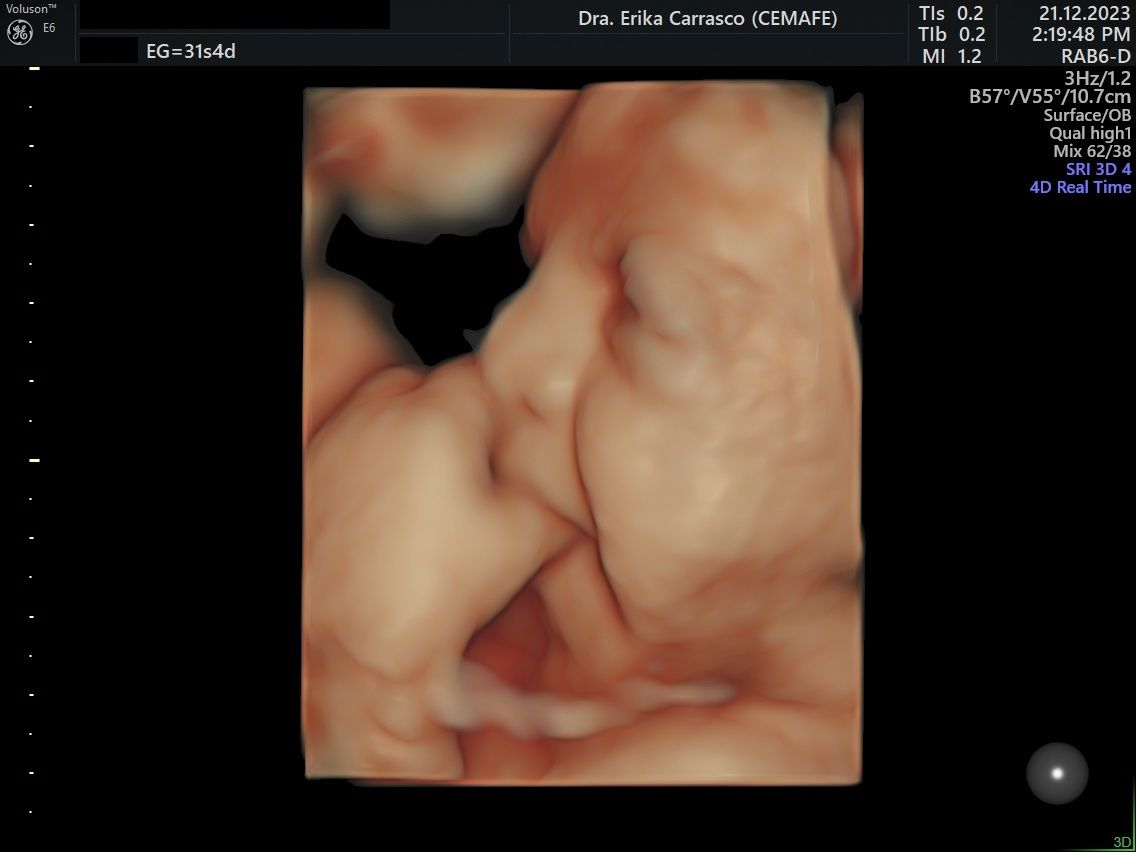 Erika Ruth Carrasco Blancas-13