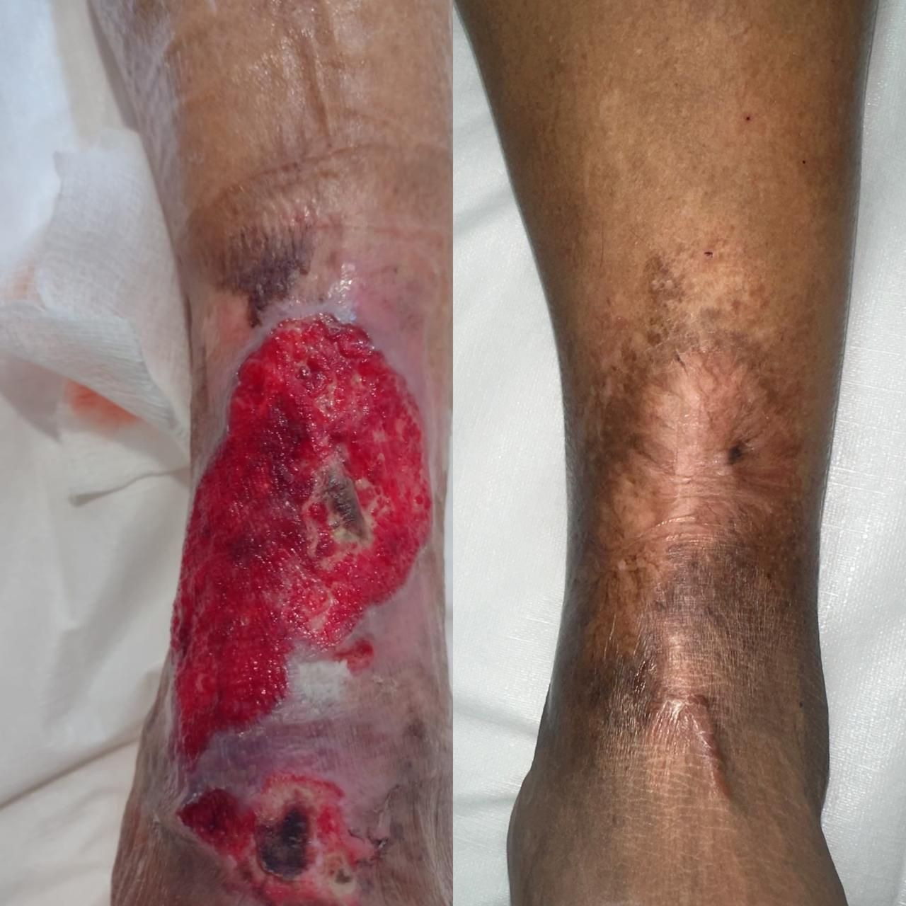 Jhonatan López González-61