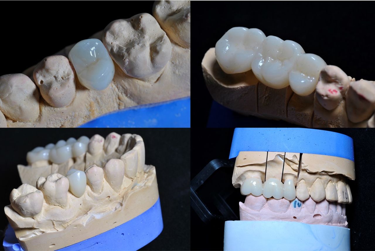 Alberto Companioni Bacha-21