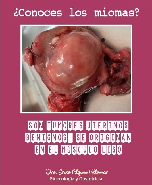 Erika Olguín Villamar-12