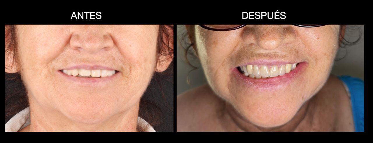 Aide Montserrat Orozco Gutierrez-49