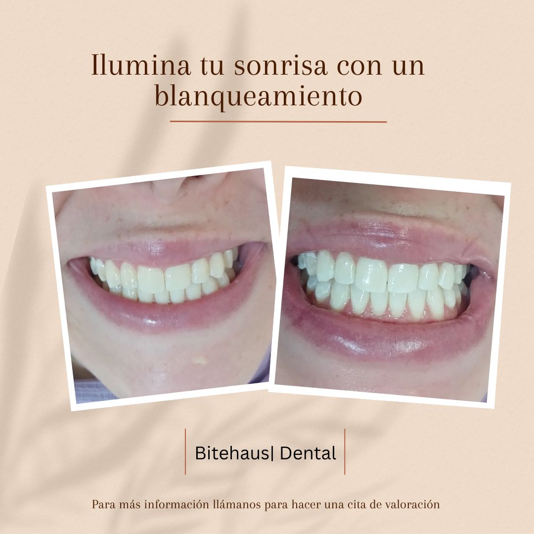 Hylse Najera Moya-11