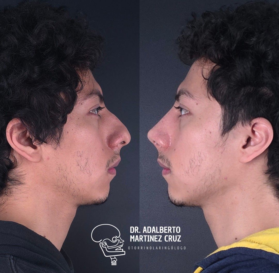 Adalberto Martínez Cruz-28