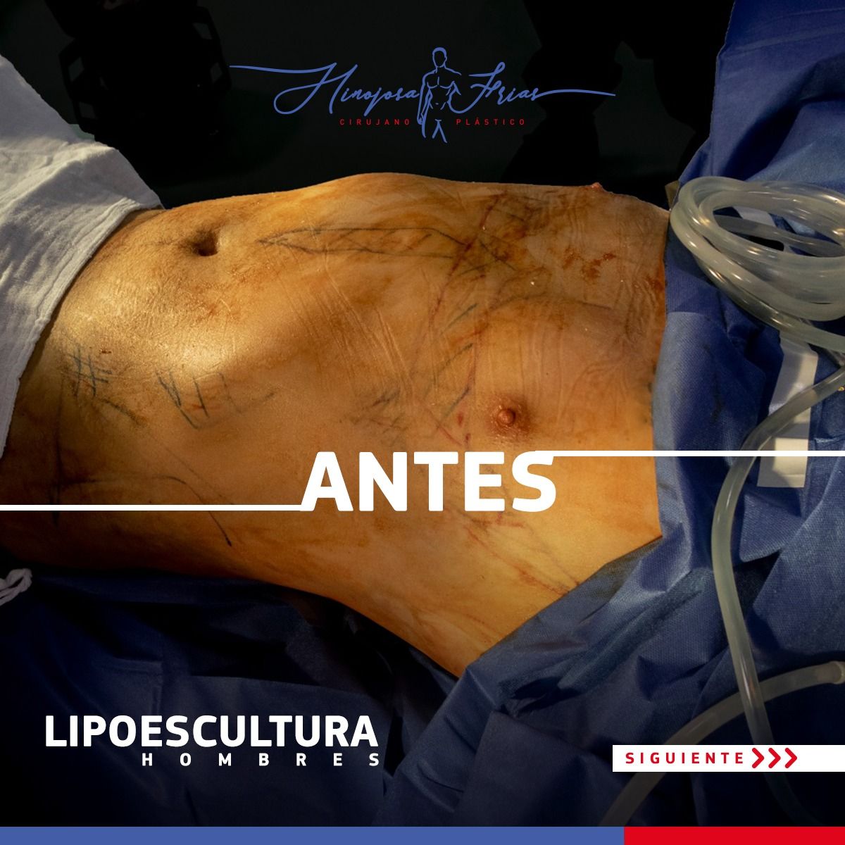 Miguel Ángel Hinojosa Frías-0