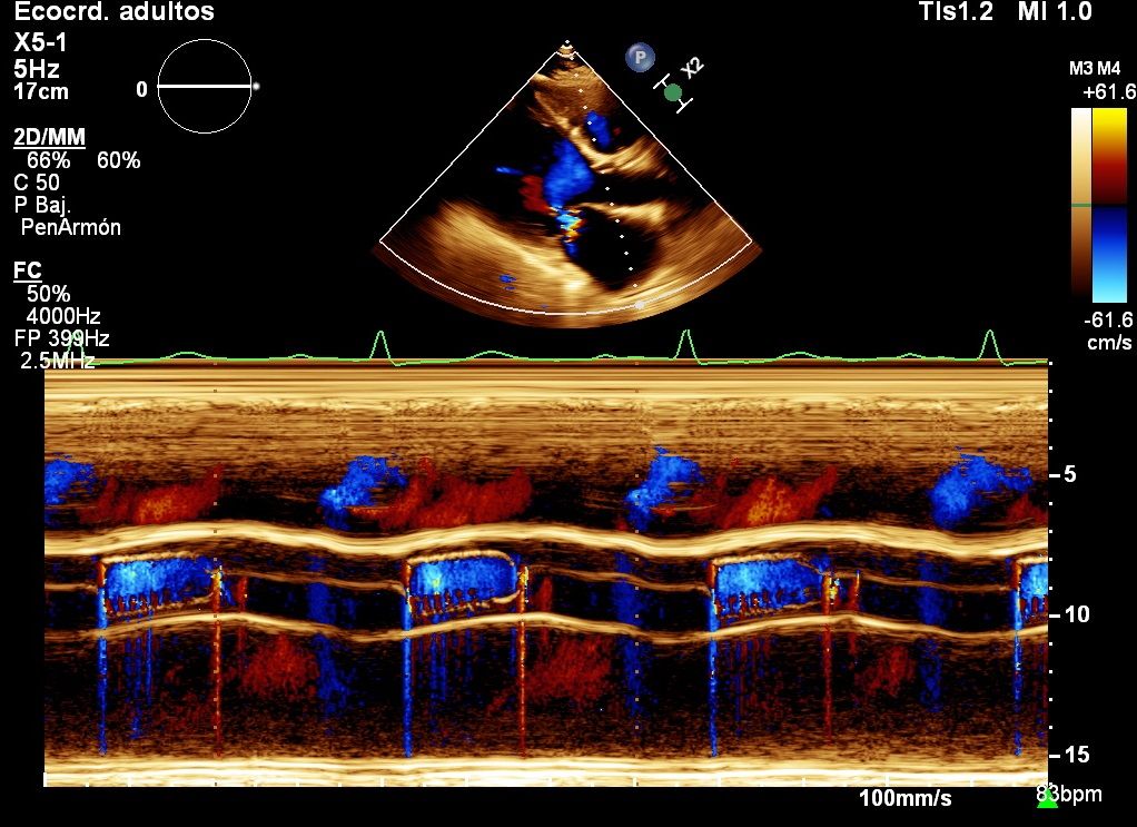 Heriberto Pruneda Ayala-7