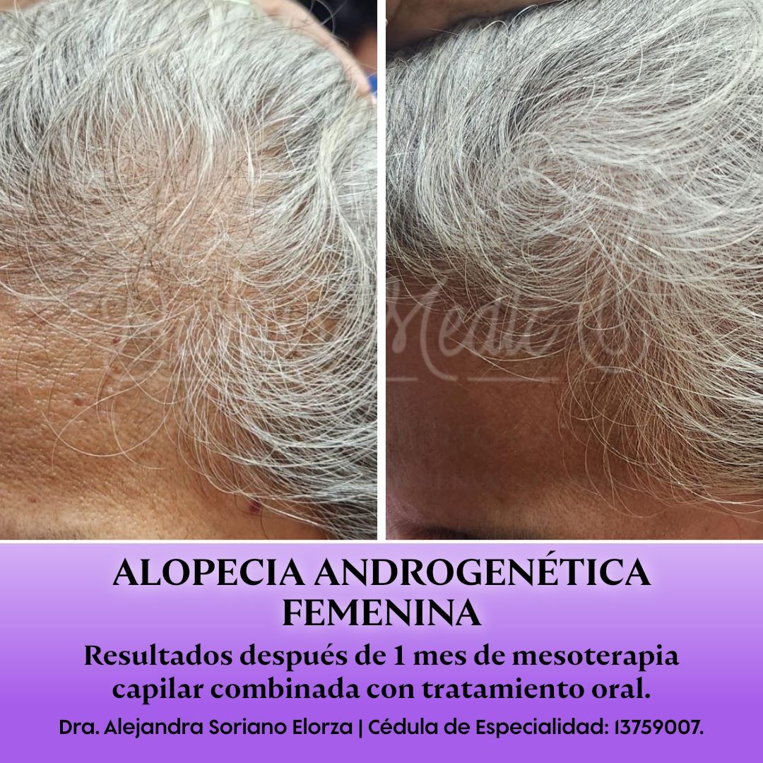 Alejandra Soriano Elorza-69