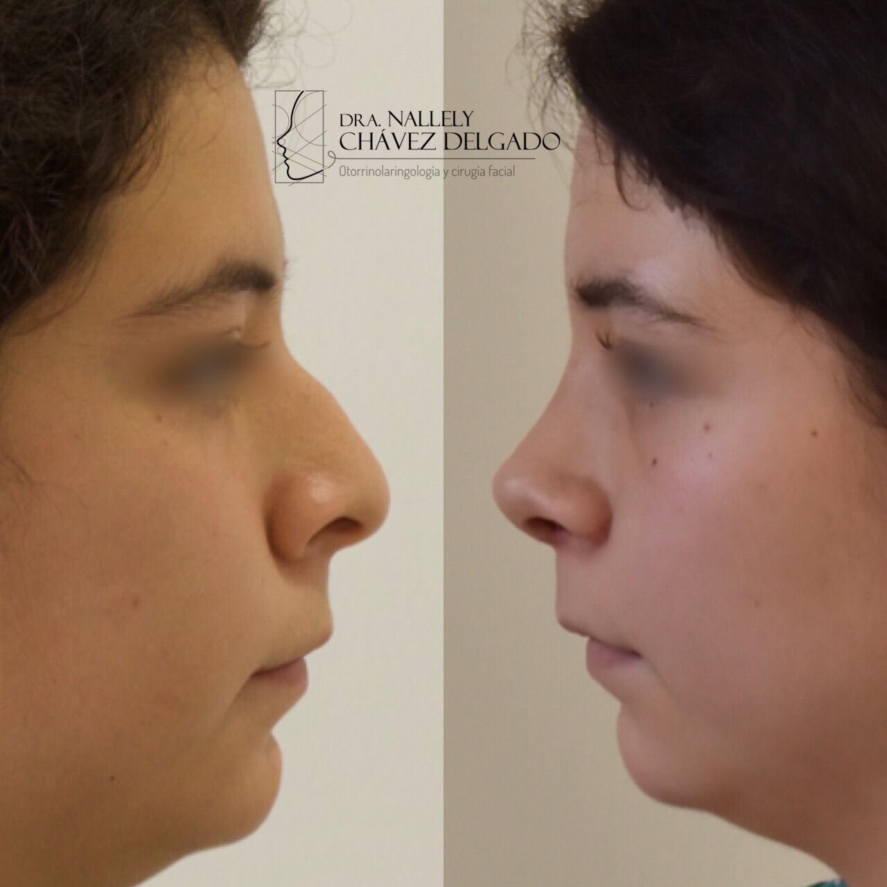 Nallely Chávez Delgado-12