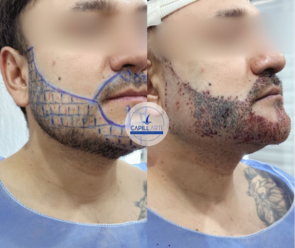 Adrian Hernandez Lopez-25