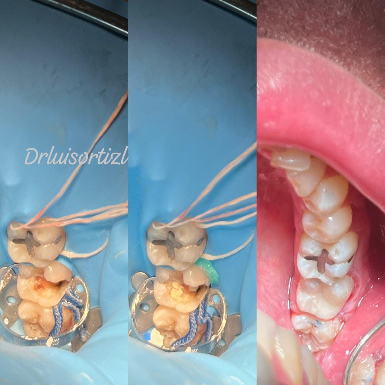 Luis Ángel Ortiz López-28