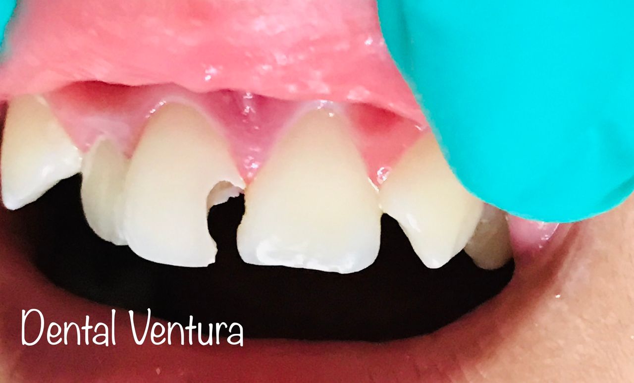 Antonio Cerda Ventura-17