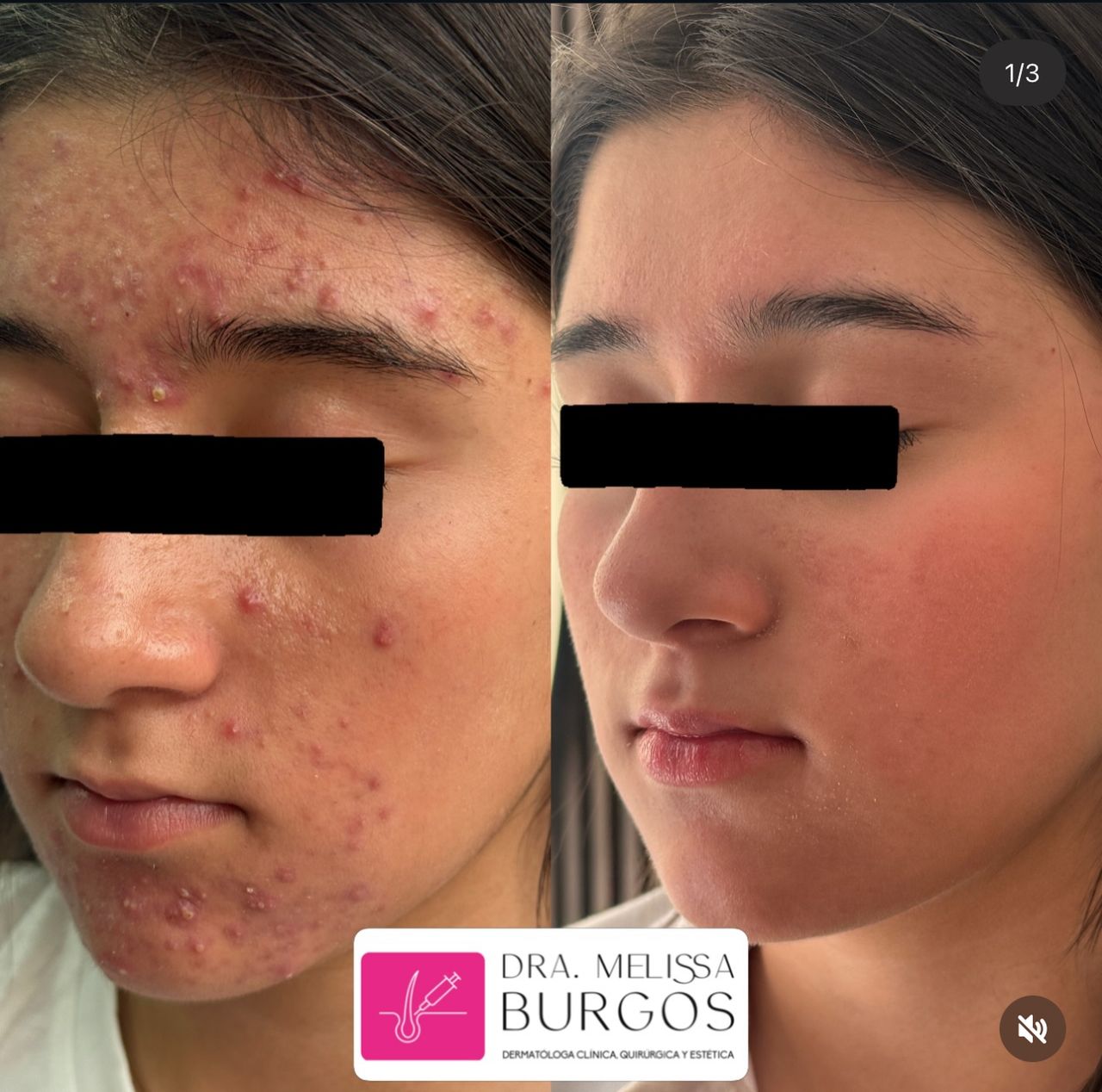 Melissa Burgos Romero-16