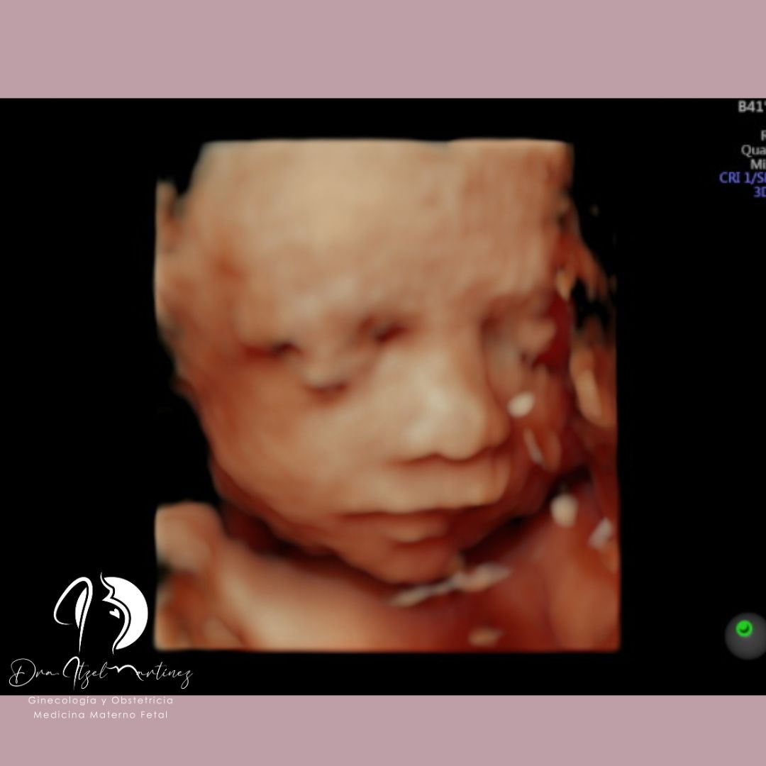 Itzel Martínez Vélez-3