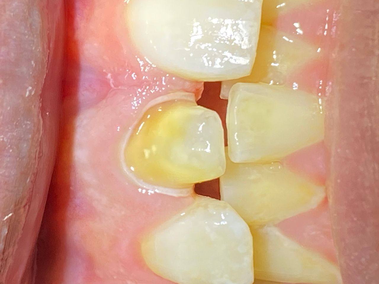 Raúl Méndez Cifuentes-5