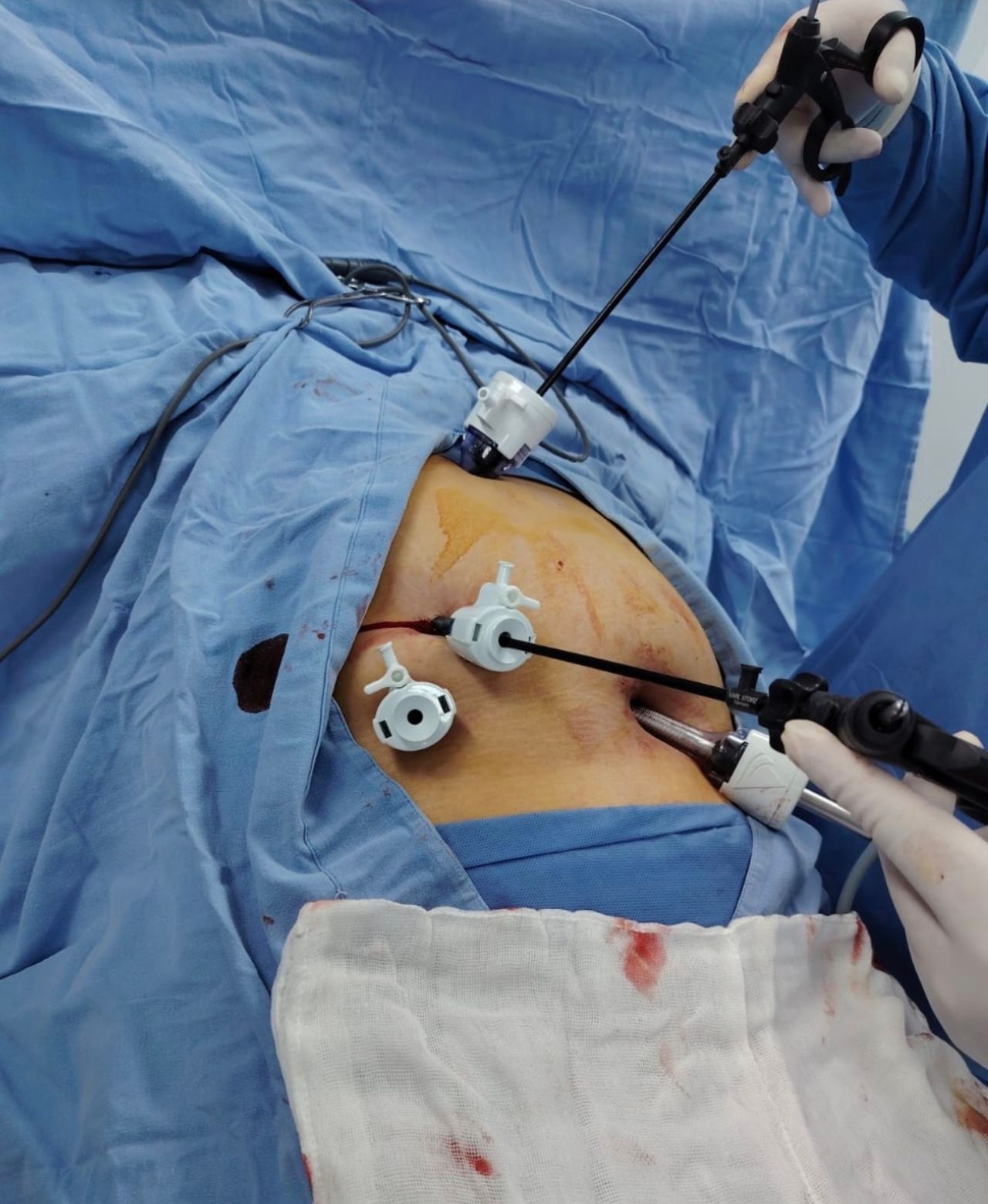 Juan Pablo Pérez Martínez-12