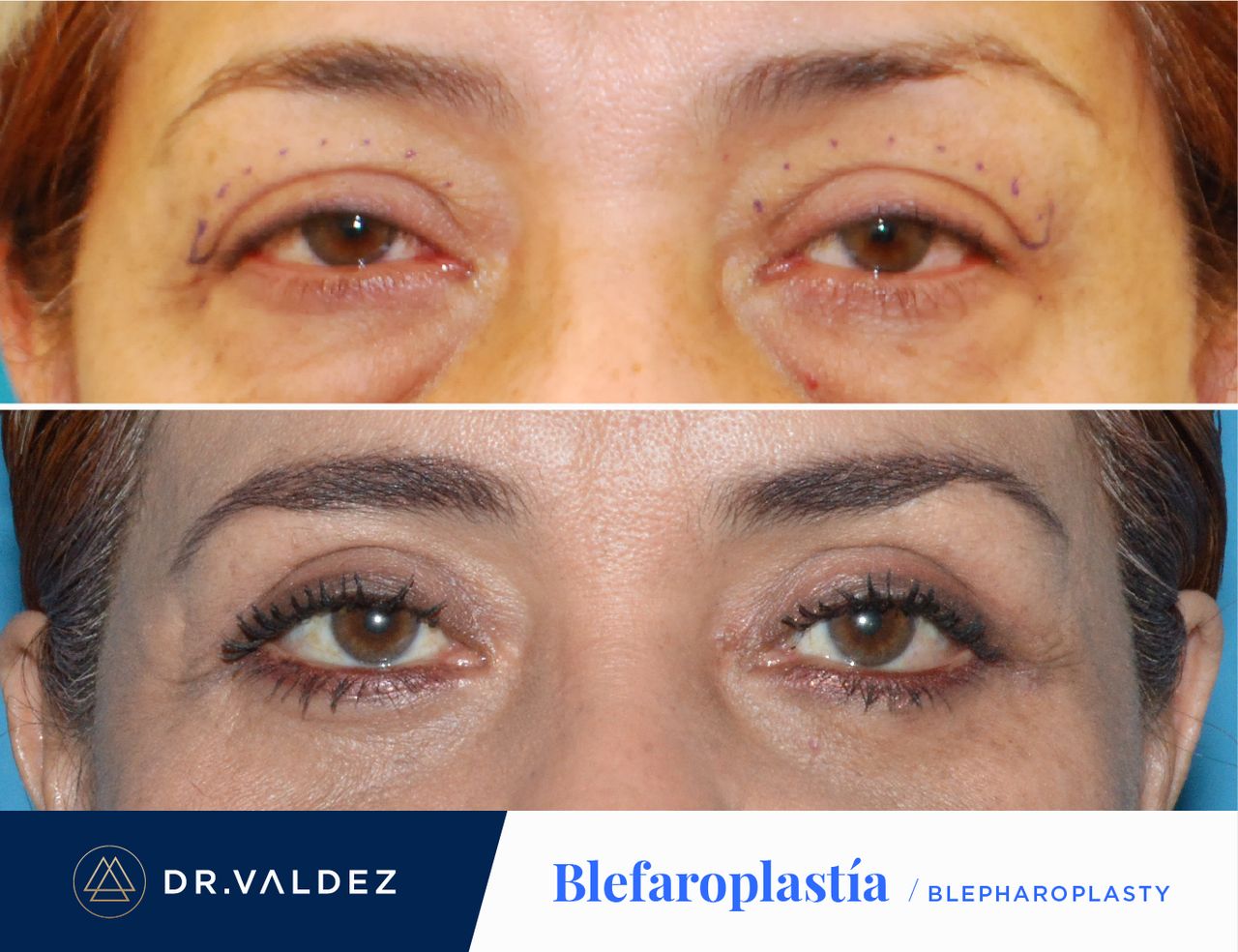 Pedro Arturo Valdez Gomez-31