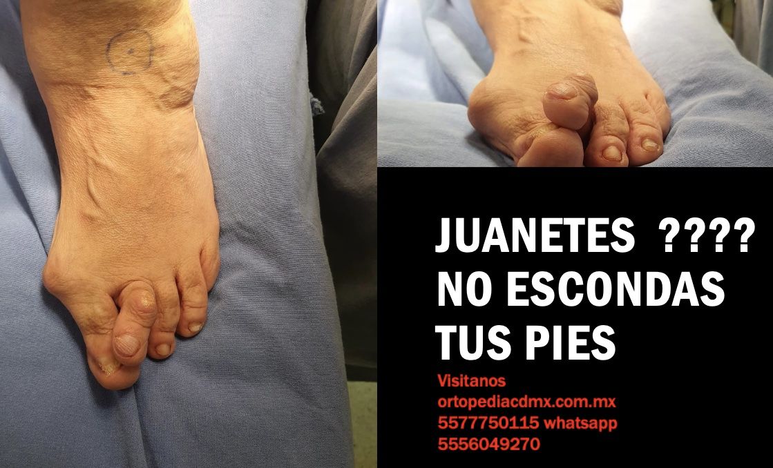 Carlos Ignacio Muñoz Valadez-17