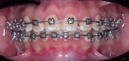 Vicente Emmanuel Silva Rangel-10