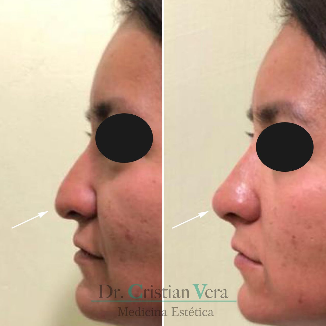 Cristian Eduardo Vera Nuño-14