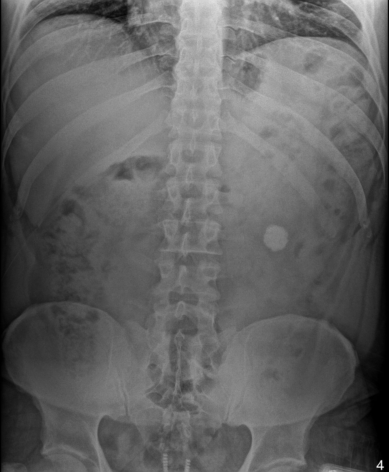 Samuel Garza Pacheco -2