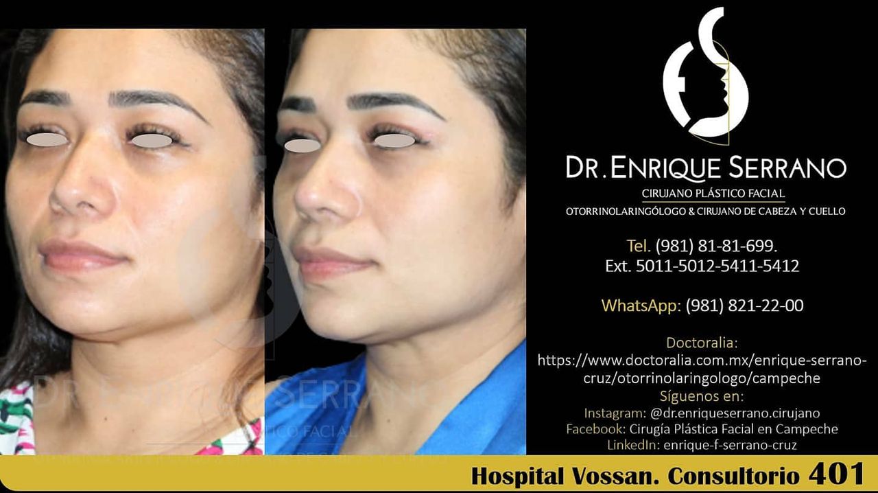 Enrique Serrano Cruz-103