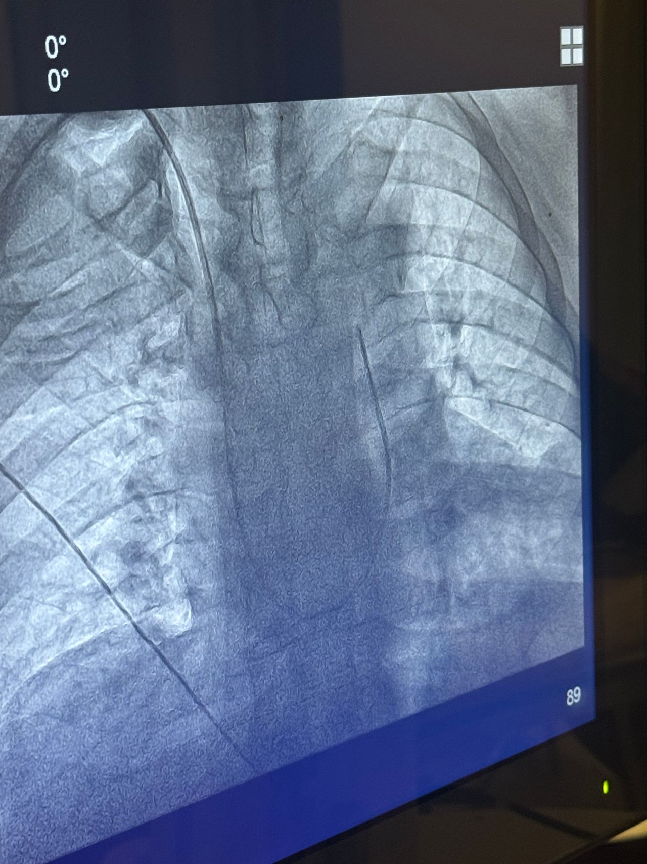 Carlos Joaquín Pech Lugo-2