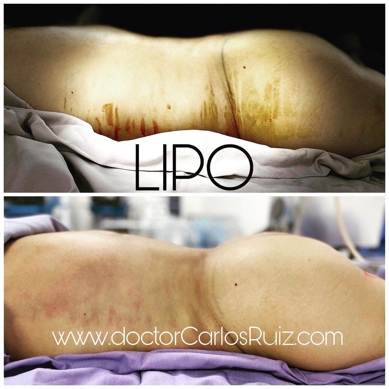 Carlos Alberto Ruiz Zepeda-19