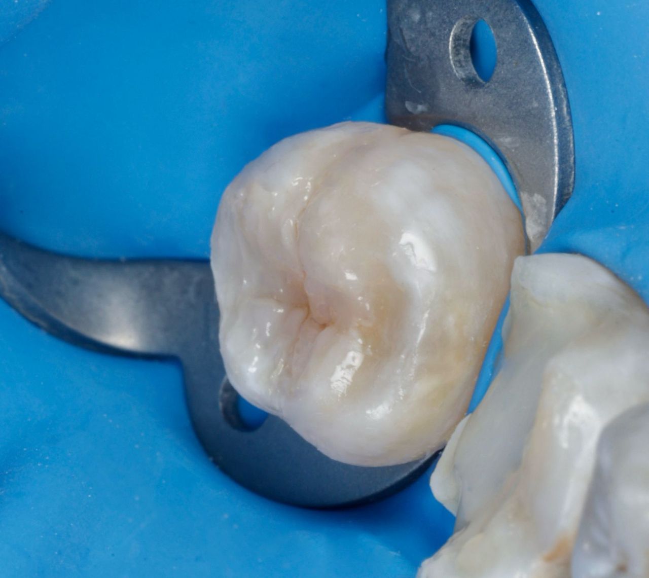 Fredy Alejandro Roblero Gónzalez-49