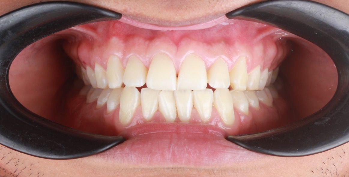 Mauricio Burgos Sánchez-12